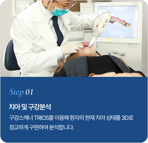 보철물 제작 과정 Step 1