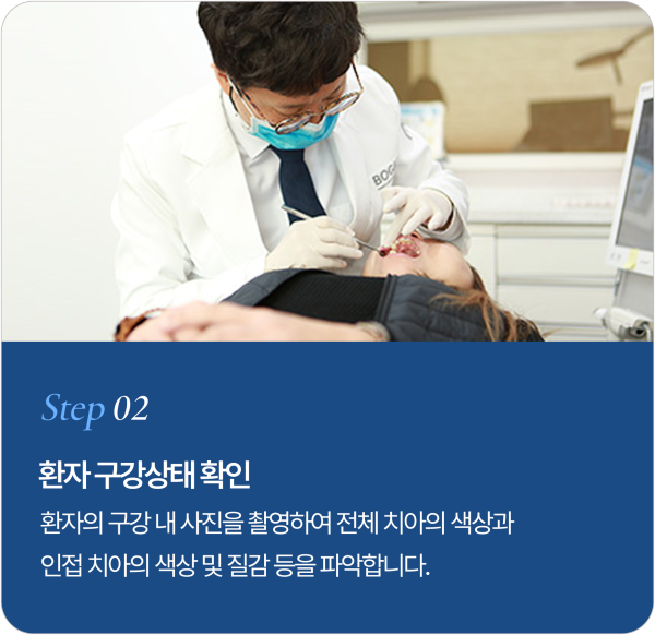 보철물 제작 과정 Step 2